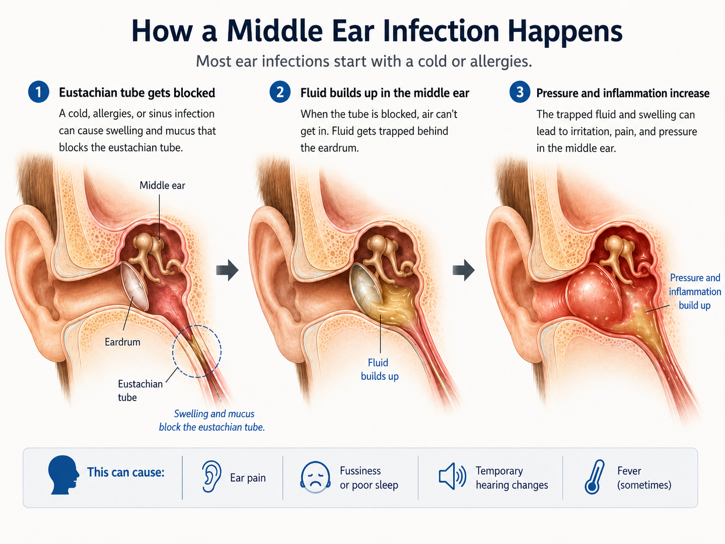 Middle Ear Infections